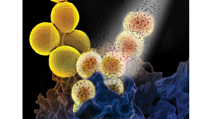MRSA cells being treated and dissolving with an antibiotic. Photo: NUI Galway